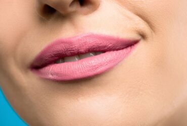 Cupid Lip Lift Los Angeles #beverlyhillsmagazine #beverlyhills #liplift #cupidlips #bentalei #lipsurgery