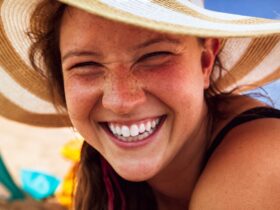 The Luxury Guide to Teeth Whitening #beverlyhills #beverlyhillsmagazine #bevhillsmag #teethwhitening #whiteteeth #dentalhealth #teeth #healthyteeth #whiteningtoothpaste #perfectteeth