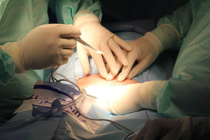 How To Minimize Surgery Scars #surgery #scarring #heal #beauty #beverlyhills #beverlyhillsmagazine #bevhillsmag