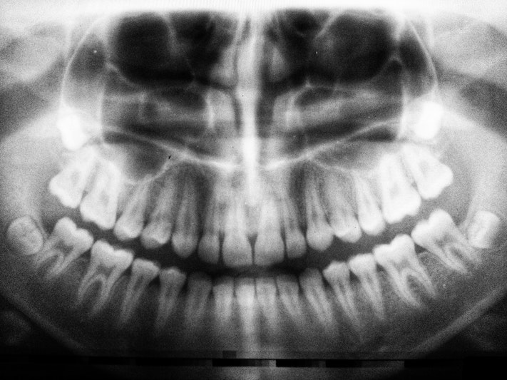 24 Hour Emergency Dental Care: #beverlyhills #beverlyhillsmagazine #dentalcare #dentist #oralhealth #emergencydentist #emergencydentaltreatment #dentalemergency #dentalproblem #dentalwork #bevhillsmag