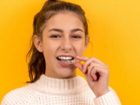 5 Factors that Influence the Cost of Invisalign Treatment #beverlyhills #beverlyhillsmagazine #Invisaligntreatment #costoftreatment #Invisaligntechnology