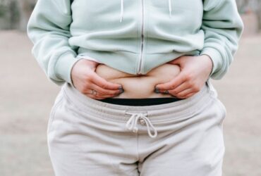 5 Safest Non-Surgical Fat Removal Procedures #beverlyhills #beverlyhillsmagazine #bevhillsmag #nonsurgicalprocedure #nonsurgicalfatremoval #weightloss #fatremoval