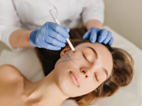 5 Useful Tips for Your First Botox Therapy #beverlyhills #beverlyhillsmagazine #bevhillsmag #botoxtreatment #botoxtherapy #cosmeticprocedure #cosmetictreatment