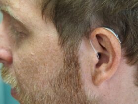 5 Ways to Monitor Your Hearing Health With Technology #beverlyhills #beverlyhillsmagazine #hearinghealth #hearingloss #earhealth #hearinghealth #bevhillsmag