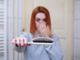 A Guide on the Common Causes of Hair Loss #hairlloss #beverlyhills #beverlyhillsmagazine #causesofhairloss #preventinghairloss #treatmentforhairloss