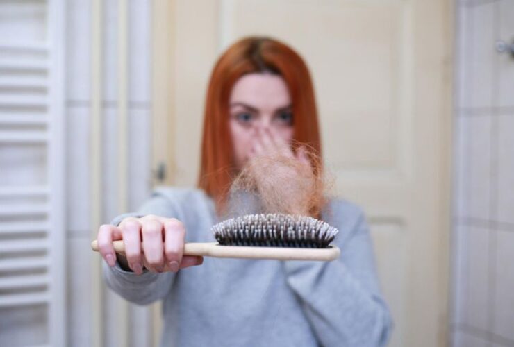 A Guide on the Common Causes of Hair Loss #hairlloss #beverlyhills #beverlyhillsmagazine #causesofhairloss #preventinghairloss #treatmentforhairloss