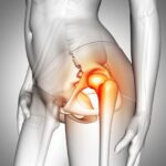 Beyond the Surface: Exploring Deep Tissue Causes of Hip Pain #beverlyhills #beverlyhillsmagazine #hippain #typeofpain #hiphealth #chiropracticcare #hipmuscles