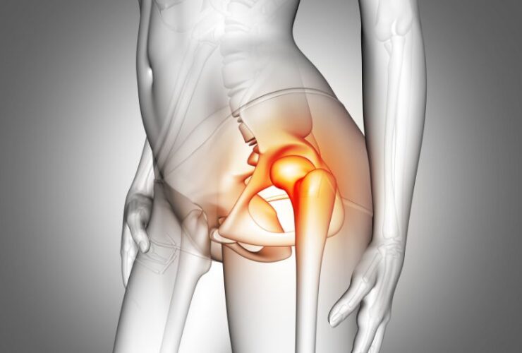 Beyond the Surface: Exploring Deep Tissue Causes of Hip Pain #beverlyhills #beverlyhillsmagazine #hippain #typeofpain #hiphealth #chiropracticcare #hipmuscles