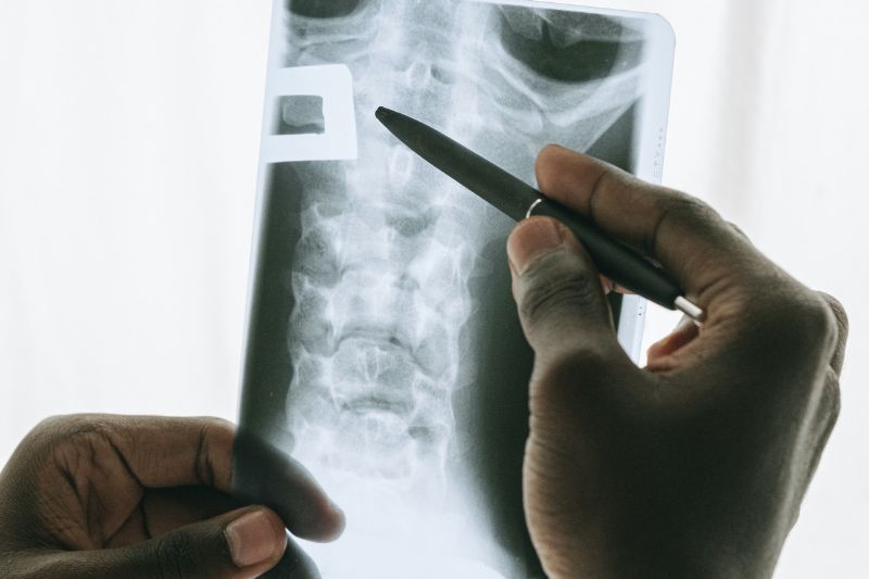 Can Stem Cells Be The Cure For Pulmonary Fibrosis? #beverlyhills #beverlyhillsmagazine #stemcells #pulmonaryfibrosis #fatallungdisease #stemcelltherapy #lungtransplant #bevhillsmag