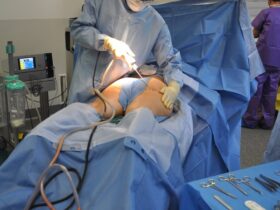 Beverly Hills Magazine Considering Plastic Surgery_ 5 Tips to Help You Make the Right Choices