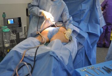 Beverly Hills Magazine Considering Plastic Surgery_ 5 Tips to Help You Make the Right Choices
