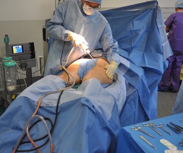 Beverly Hills Magazine Considering Plastic Surgery_ 5 Tips to Help You Make the Right Choices