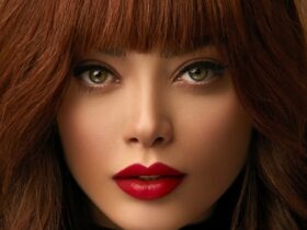 Cupid Lips Los Angeles #beverlyhillsmagazine #beverlyhills #liplift #cupidlips #bentalei #lipsurgery