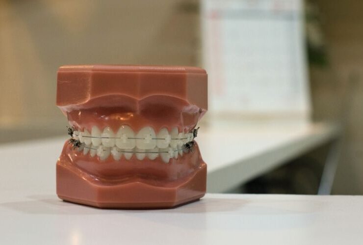 Dentists Share Their Favorite Dental Urban Legends #dentists #dental care