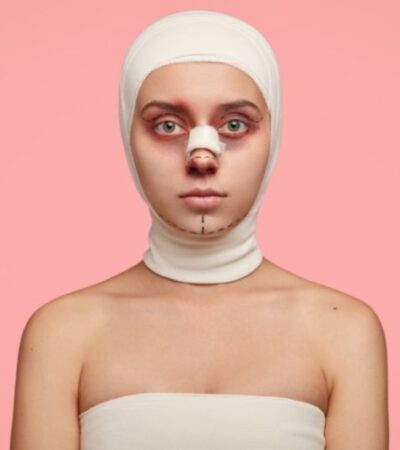 How To Choose A Rhinoplasty Surgeon #beverlyhills #beverlyhillsmagazine #bevhillsmag #rhinoplastysurgeion #rhinoplastysurgeries #facialconstructiveprocedure #noseenhancementprocedure #medicalprofession #medical licenses