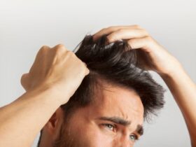 How To Handle Hair Loss Properly #hairthinning #hairloss #balding #beauty
