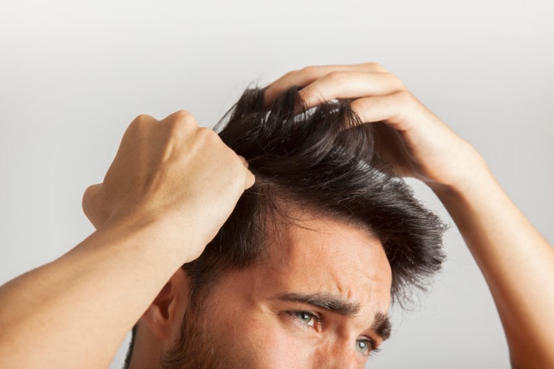 How To Handle Hair Loss Properly #hairthinning #hairloss #balding #beauty