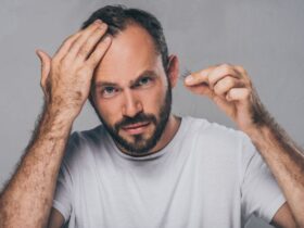 How To Reduce Hair Loss #beverlyhills #beverlyhillsmagazine #reducehairloss #hairloss #hairtreatment #hairtransplant #promotehealthyhairgrowth