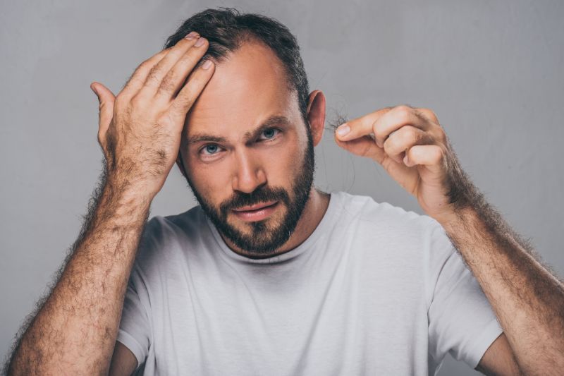How To Reduce Hair Loss #beverlyhills #beverlyhillsmagazine #reducehairloss #hairloss #hairtreatment #hairtransplant #promotehealthyhairgrowth