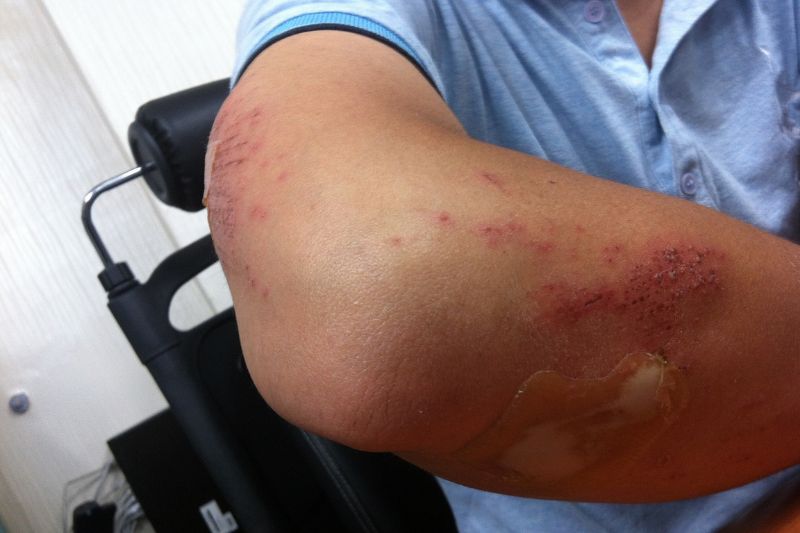 Injured on a Business Trip? Here’s What You Must Do #beverlyhills #beverlyhillsmagazine #businesstrip #personalinjurylawyer #medicalattention #personalinjurylawsuit