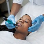 Microneedling: A Useful Guide #beverlyhills #beverlyhillsmagazine #bevhillsmag #keepyourskinhydrated #medicaltreatment #acnetreatment #microneedling #improveyourskin #acnescars