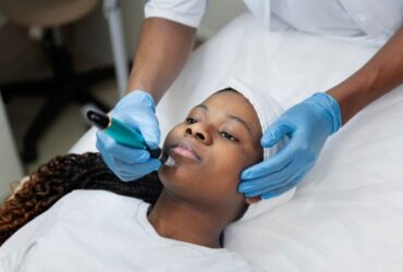 Microneedling: A Useful Guide #beverlyhills #beverlyhillsmagazine #bevhillsmag #keepyourskinhydrated #medicaltreatment #acnetreatment #microneedling #improveyourskin #acnescars