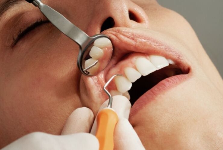 Most Common Dental Procedures in Hollywood #beverlyhills #beverlyhillsmagazine #bevhillsmag #dentalprocedure #beverlyhillscelebrities #dentist #bevhillsmag