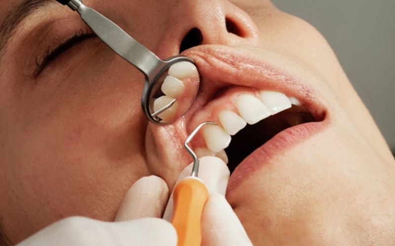 Most Common Dental Procedures in Hollywood #beverlyhills #beverlyhillsmagazine #bevhillsmag #dentalprocedure #beverlyhillscelebrities #dentist #bevhillsmag