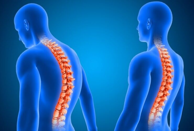 Orthopedic Spine Surgeon Wayne: An Expert On Spine Problems #beverlyhills #beverlyhillsmagazine #bevhillsmag #orthopedicspinesurgeon #spineproblem #spinetreatment #non-surgicaltherapies #spinesurgeon