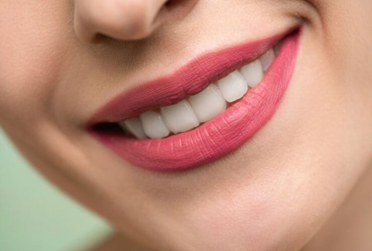 Things You Should Know About Cosmetic Dentistry #beverlyhills #beverlyhillsmagazine #bevhillsmag #cosmeticdentistry #cosmeticdentist #teethwhitening #improveyoursmile