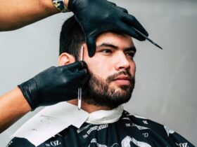 Understanding Beard to Scalp Transplants: #beverlyhills #beverlyhillsmagazine #bevhillsmag #beard #beardtoscalptransplant #transplant #hairtransplants #hairtransplantsurgeon #scalp