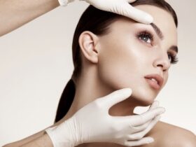 5 Reasons Why People Get A Facelift #beauty #beautiful #plasticsurgery #beverlyhills #beverlyhillsmagazine #cosmeticsurgery #vanity