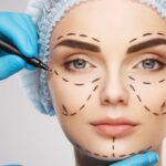 9 Plastic Surgery Procedures Health Insurance May Cover #plasticsurgery #beautymagazine #healthinsurance #beverlyhills #beverlyhillsmagazine #bevhillsmag