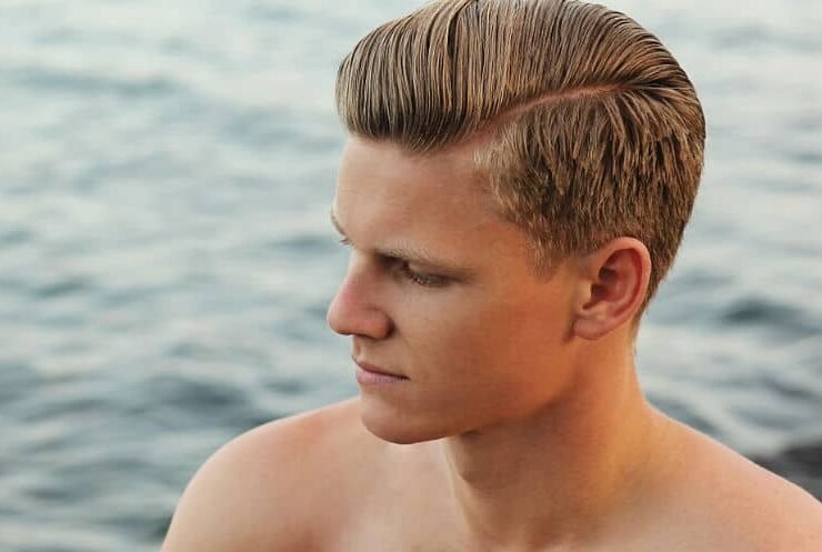 Hair Transplant Surgery 101: The Recovery Progress #balding #thinhair #hairtransplant #beauty #beverlyhills #bevelryhillsmagazine #bevhillsmag