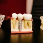3 ways to take better care of your teeth:#keepingyourteethclean #takingcareofyourteeth #beverlyhillsmagazine #beverlyhills #dentist #naturaltoothpaste #toothwhitening