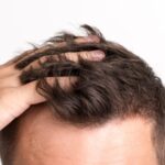 What To Do When Your Hair Starts Thinning #hair #hairthinning #hairloss #beauty #grooming