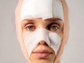 The Top 5 Things About Facelift Cost #FaceliftGuide, #CosmeticSurgeryTips, #FaceliftCost, #BeautyBudget, #SurgeryFacts, #AestheticTips, #AntiAgingInfo, #CosmeticGuide, #PlasticSurgery101, #FaceLiftFacts