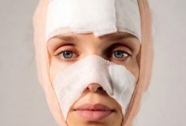The Top 5 Things About Facelift Cost #FaceliftGuide, #CosmeticSurgeryTips, #FaceliftCost, #BeautyBudget, #SurgeryFacts, #AestheticTips, #AntiAgingInfo, #CosmeticGuide, #PlasticSurgery101, #FaceLiftFacts
