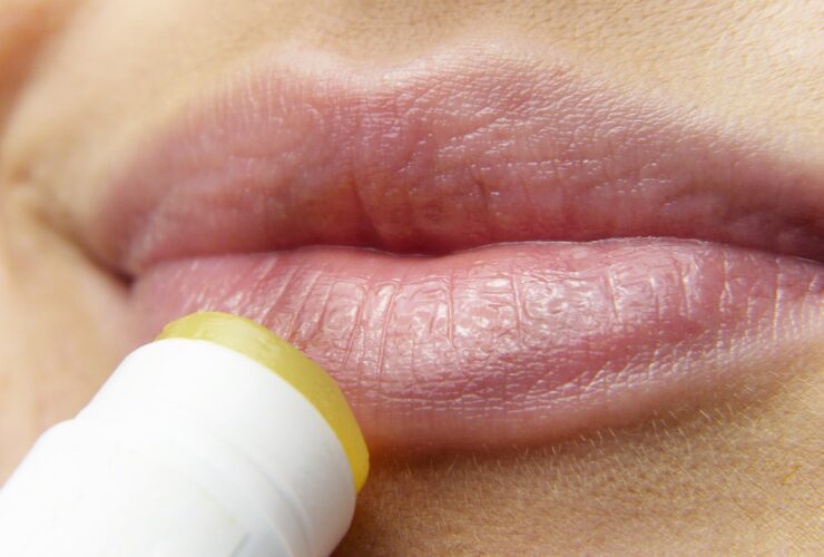 A Holistic Cure: Methods To Heal Herpes Naturally #health #herpes #medicine #cureherpes #bevhillsmag